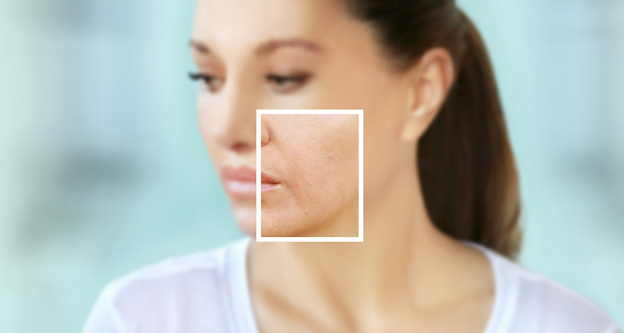 Vieillissement cutané